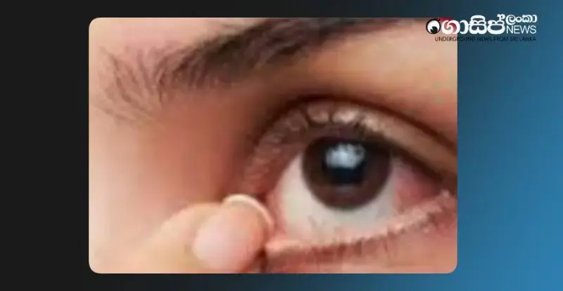 risk-of-eye-disease-spreading-in-ditwa-idp-camps