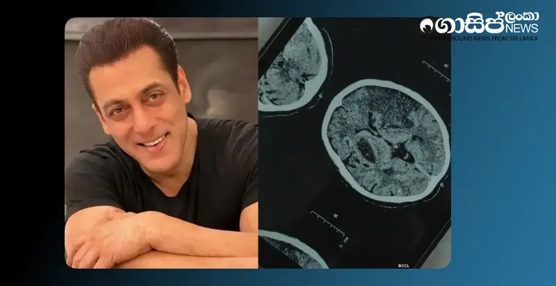 salman-khan-says-he-is-suffering-from-three-serious-neurological-diseases