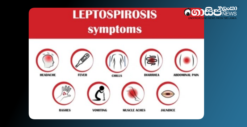 26-die-of-rat-fever-in-anuradhapura-district