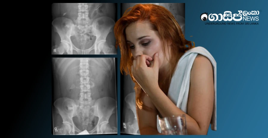 uterus-glass-bottles-removed