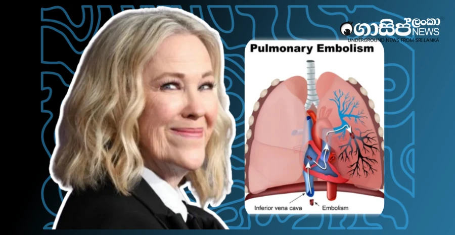 after-the-death-of-the-hollywood-actress-special-attention-was-paid-to-the-blood-clot-in-the-lungs