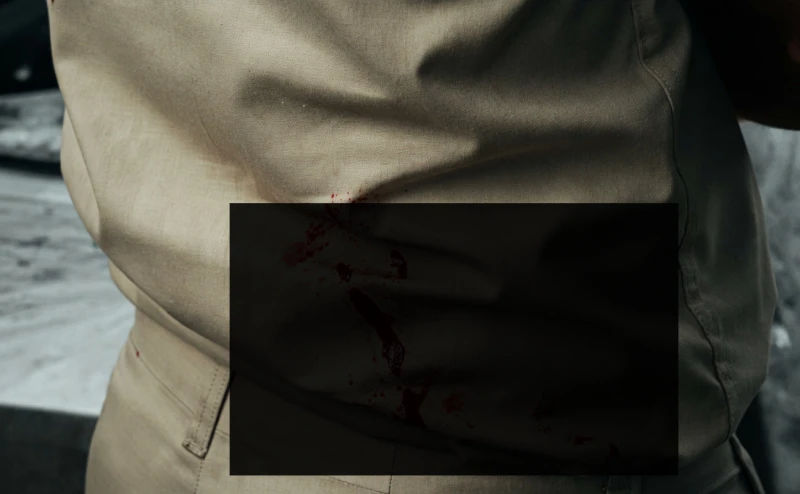 knife-attack-in-an-eppawala-school-five-students-in-hospital
