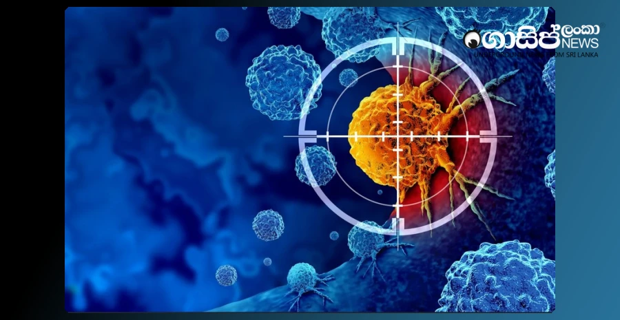 18000-new-cancer-patients-are-diagnosed-annually-in-sri-lanka
