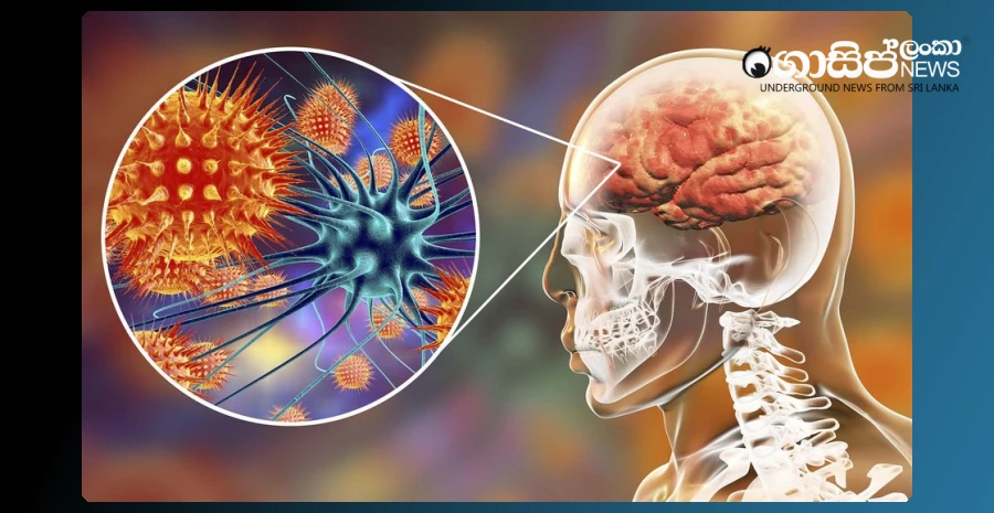 150-schoolgirls-with-meningitis-have-been-met---one-girl-is-serious