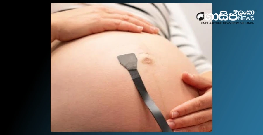 a-patch-is-produced-for-continuous-monitoring-of-the-condition-of-the-pregnant-mothers-child