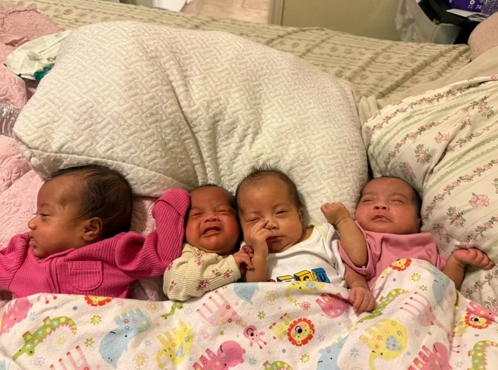 identical-quadruplets-grown-in-the-same-embryo