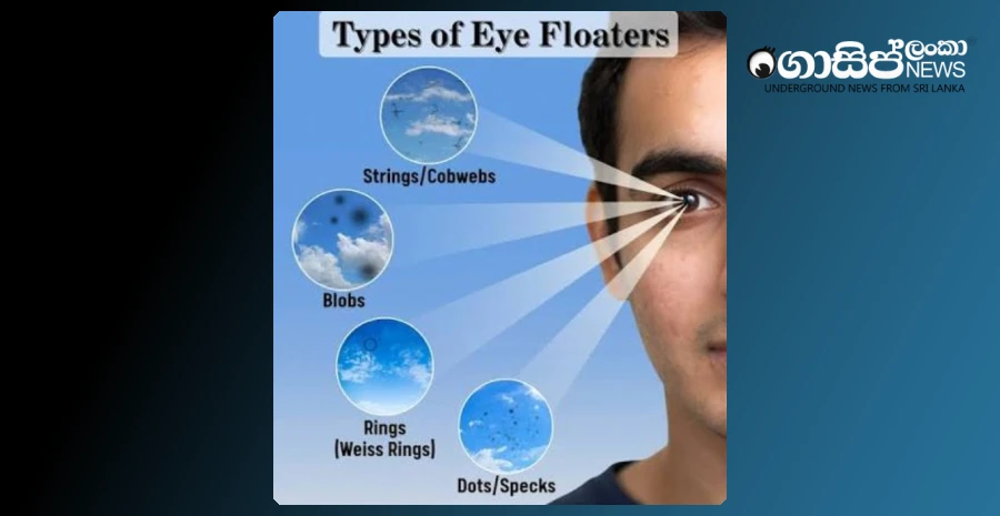 see-a-doctor-if-you-see-floating-spots-in-front-of-the-eyes