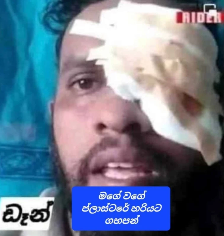did-shiranthi-really-have-an-eye-disease-from-the-eye-ward-back-to-the-welikada-ward